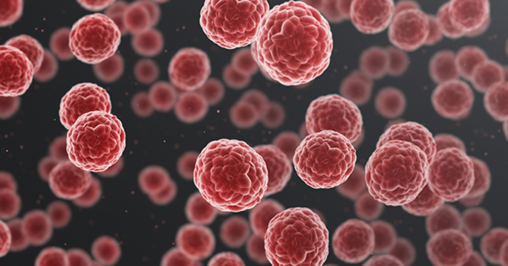 Cancer kills 10,000 Nigerians annually